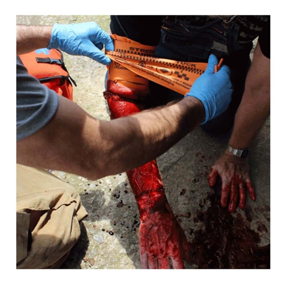 Applying SWAT-T Rescue Tourniquet to a bleeding wound in emergency first aid by tree surgeons.